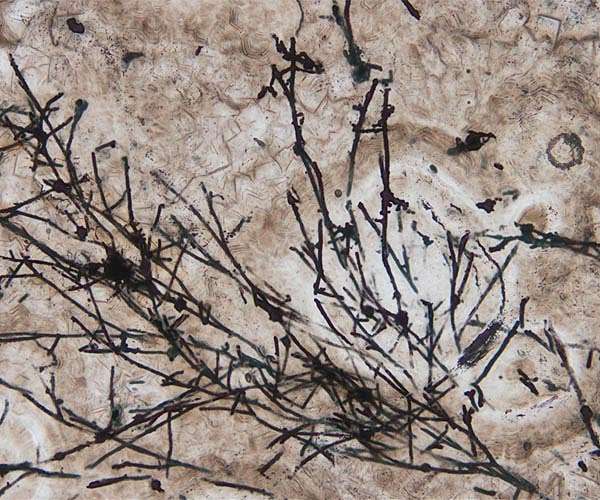 Ancient fungi-like microfossil that bailed us out of an ice age discovered