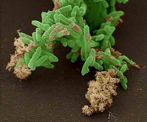 Microbes generate electricity while cleaning up nuclear waste