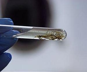 Strangers invade the homes of giant bacteria