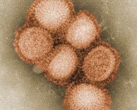 US experts confident of containing swine flu