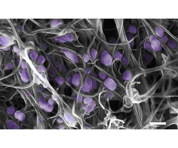 China confirms first human case of bird flu strain