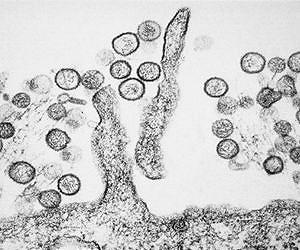 Yosemite extends hantavirus alert to 230,000