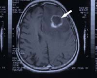 Software turns 2-D medical scans into 3-D