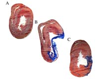 Can Heart Tissue Be Regenerated
