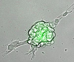 How to make stem cells - nuclear reprogramming moves a step forward