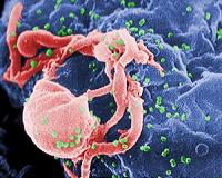 HIV may help prevent multiple sclerosis: study