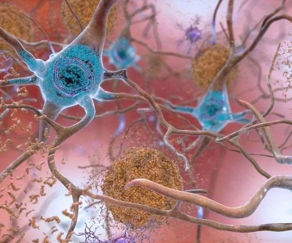 GSI Biophysics experiment to study brain organoids in ISS microgravity mission