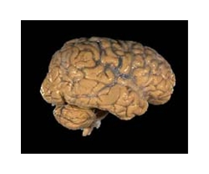 Replay Helps Brain's Decision-Making Process