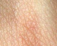 Skin pigment renders sun's UV radiation harmless using projectiles