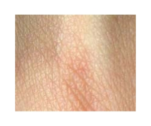 Touch-sensitive plastic skin heals itself