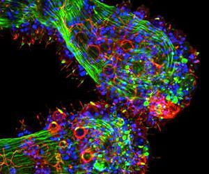 Seeing without eyes: Hydra stinging cells respond to light