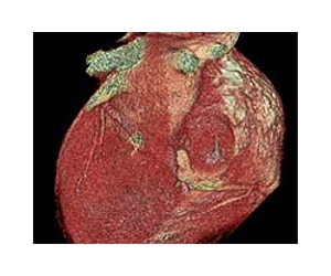 Researchers looking to create human heart