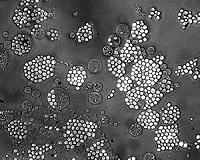 Microgravity Helping Us Understand Immune System's Tiny Warriors