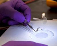 New Implanted Devices May Reshape Medicine
