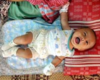 Malnutrition in eastern Indonesia 'higher than in Africa': aid group
