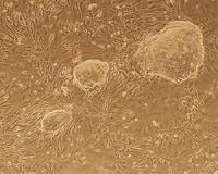 Cell memory loss enables the production of stem cells