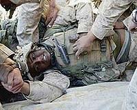 Hospital On A Chip Could Revolutionize Treatment Of Battlefield Wounds