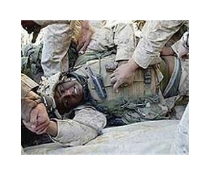 In Iraq war, a revolution in battlefield medicine