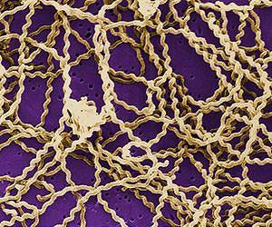 How bacteria respond so quickly to external changes