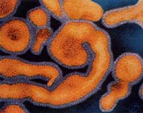 Hundreds dead in Burkina meningitis epidemic: ministry
