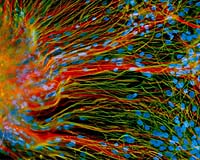 Stem Cells Create Blood Vessels