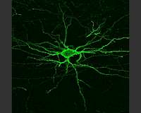 Scientists classify neurons by measuring their jiggle during a heartbeat