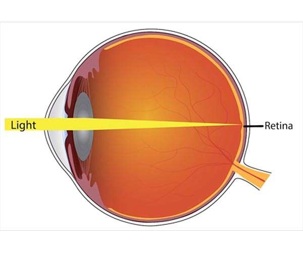 Men show significant ocular changes after space travel