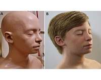 When Hollywood met neurosurgery