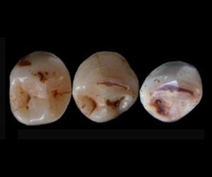 Ancient Teeth Raise New Questions About The Origins Of Modern Man