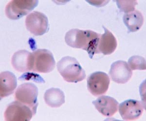 New opportunity for rapid treatment of malaria