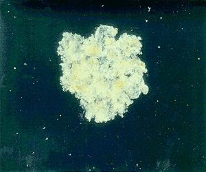Pathogens Float On Tiny Clumps Of Aquatic Detritus