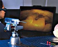 Smallest 3-D Camera Offers Brain Surgery Innovation