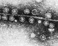 Study finds vast diversity among viruses that infect bacteria