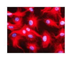 Discovery of quantum vibrations in 'microtubules' corroborates theory of consciousness