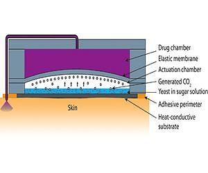 Body heat, fermentation drive new drug-delivery 'micropump'
