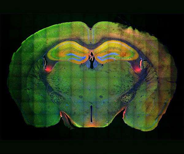 Neuroscientists discover a molecular mechanism that allows memories to form
