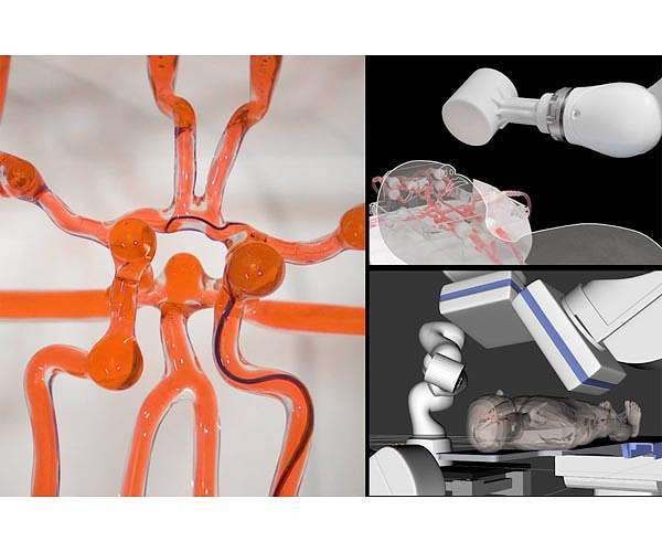 Joystick-operated robot could help surgeons treat stroke remotely
