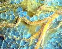 Microscope using UV instead of visible light emerging as diagnostic tool