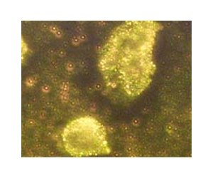 Gold nanoparticles bring scientists closer to a treatment for cancer