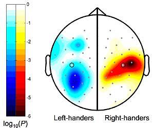 Emotion Reversed In Left-Handers' Brains Holds New Implications For Treatment Of Anxiety And Depression