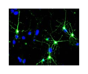Scientists Glimpse Dance Of Skeletons Inside Neurons
