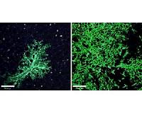 Stem cells might heal damaged lungs