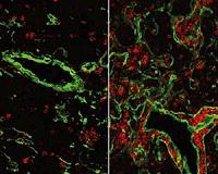 500 million year reset for the immune system