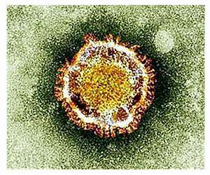 Pandora virus - covert threat from space?