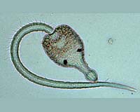 Neglected Tropical Diseases Take Devastating Toll In Sub-Saharan Africa