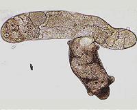 Parasitic flatworms flout global biodiversity patterns