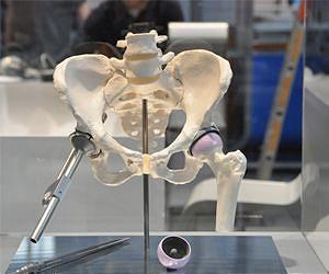 Hip implant for long-term use
