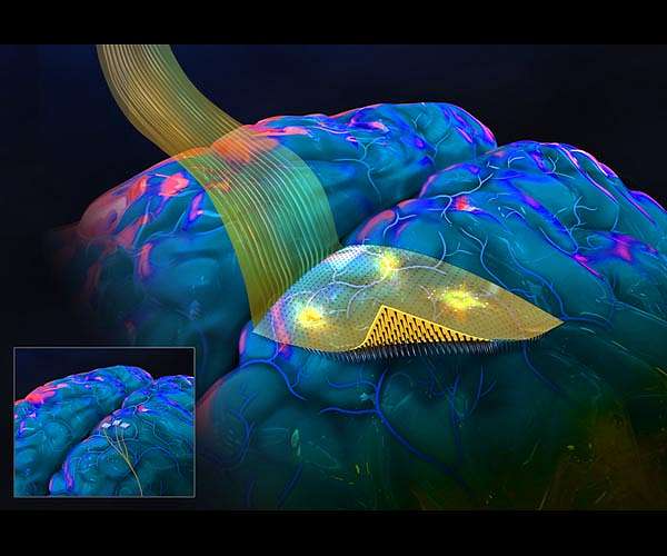 A new brain-computer interface with a flexible backing
