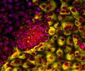 Physical cues help mature cells revert into embryonic-like stem cells