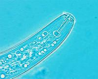 Bacteria discovery offers possible new means of controlling crop pest